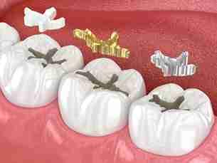 Image Source -Directory dental Liverpool
