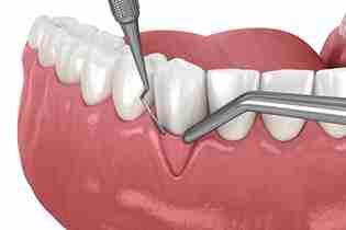 Image Source -Directory dental Liverpool